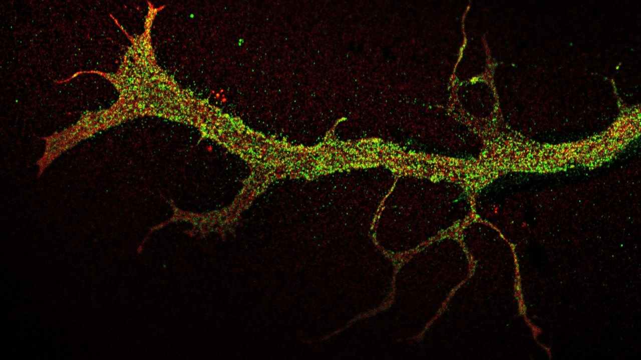 Green dots come together to make a vein-like image